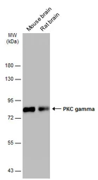 Anti-PKC gamma antibody used in Western Blot (WB). GTX107639