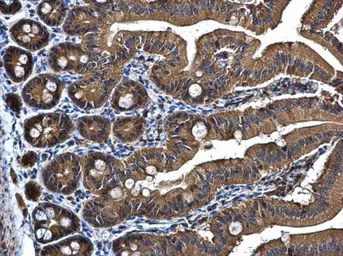 Anti-PRPSAP2 antibody [N1C3] used in IHC (Paraffin sections) (IHC-P). GTX107648