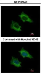 Anti-PRPSAP2 antibody [N1C3] used in Immunocytochemistry/ Immunofluorescence (ICC/IF). GTX107648