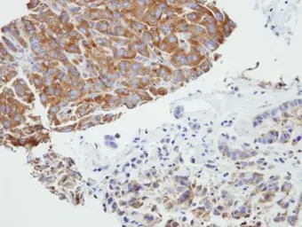 Anti-PRPSAP2 antibody [N1C3] used in IHC (Paraffin sections) (IHC-P). GTX107648