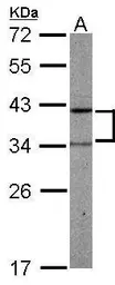 Anti-PRPSAP2 antibody [N1C3] used in Western Blot (WB). GTX107648