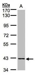 Anti-PRPSAP2 antibody [N1C3] used in Western Blot (WB). GTX107648