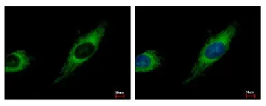 Anti-TBRG4 antibody used in Immunocytochemistry/ Immunofluorescence (ICC/IF). GTX107663