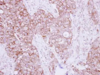 Anti-TBRG4 antibody used in IHC (Paraffin sections) (IHC-P). GTX107663