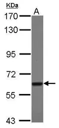 Anti-TBRG4 antibody used in Western Blot (WB). GTX107663