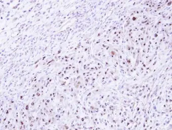 Anti-DRAK1 antibody [N1C1-2] used in IHC (Paraffin sections) (IHC-P). GTX107669