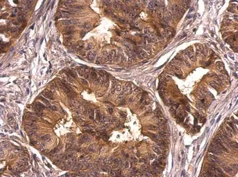 Anti-CrkL antibody used in IHC (Paraffin sections) (IHC-P). GTX107677