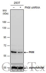 Anti-PKM antibody used in Western Blot (WB). GTX107681
