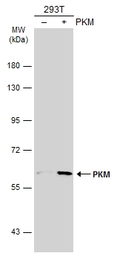 Anti-PKM antibody used in Western Blot (WB). GTX107681