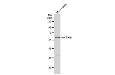 Anti-PKM antibody used in Western Blot (WB). GTX107681