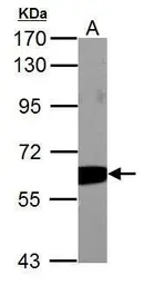 Anti-PKM antibody used in Western Blot (WB). GTX107681