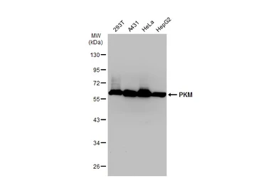Anti-PKM antibody used in Western Blot (WB). GTX107681