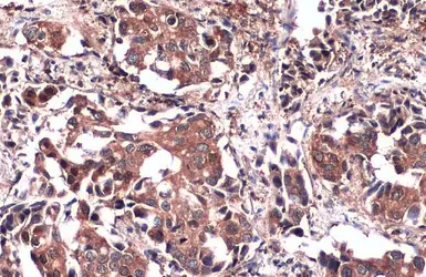 Anti-PKM antibody used in IHC (Paraffin sections) (IHC-P). GTX107681