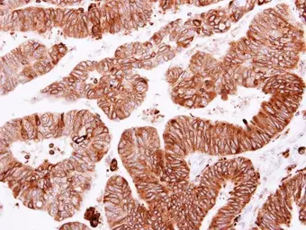 Anti-SCRIB antibody used in IHC (Paraffin sections) (IHC-P). GTX107692