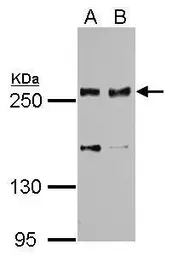 Anti-SCRIB antibody used in Western Blot (WB). GTX107692