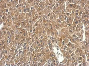 Anti-SH3BP1 antibody used in IHC (Paraffin sections) (IHC-P). GTX107693