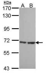 Anti-SH3BP1 antibody used in Western Blot (WB). GTX107693