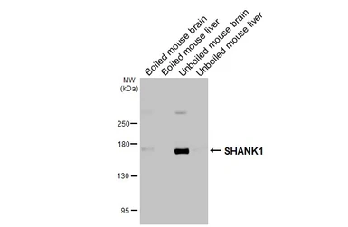 Anti-SHANK1 antibody [C3], C-term used in Western Blot (WB). GTX107701