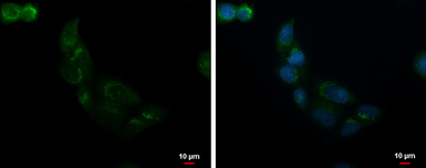 Anti-ALS2CR2 antibody [C3], C-term used in Immunocytochemistry/ Immunofluorescence (ICC/IF). GTX107704