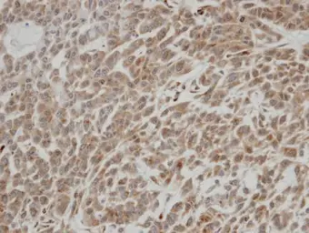 Anti-ALS2CR2 antibody [C3], C-term used in IHC (Paraffin sections) (IHC-P). GTX107704