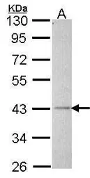 Anti-ALS2CR2 antibody [C3], C-term used in Western Blot (WB). GTX107704