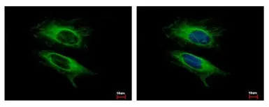 Anti-VPS11 antibody used in Immunocytochemistry/ Immunofluorescence (ICC/IF). GTX107706