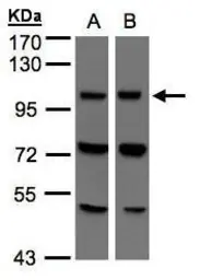 Anti-VPS11 antibody used in Western Blot (WB). GTX107706