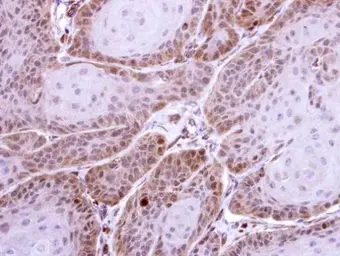 Anti-HS1BP3 antibody [C2C3], C-term used in IHC (Paraffin sections) (IHC-P). GTX107715