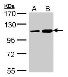 Anti-TRAK2 antibody [C3], C-term used in Western Blot (WB). GTX107718