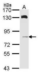 Anti-HPS6 antibody [C1], Internal used in Western Blot (WB). GTX107720