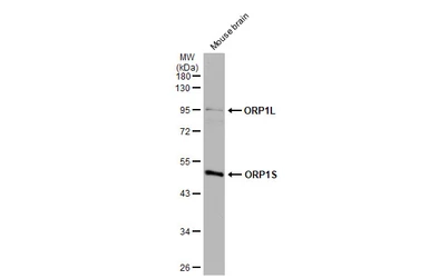 Anti-ORP1 antibody [C3], C-term used in Western Blot (WB). GTX107722