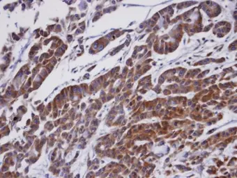 Anti-ORP1 antibody [C3], C-term used in IHC (Paraffin sections) (IHC-P). GTX107722