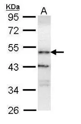 Anti-ORP1 antibody [C3], C-term used in Western Blot (WB). GTX107722