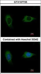 Anti-EVC2 antibody [C3], C-term used in Immunocytochemistry/ Immunofluorescence (ICC/IF). GTX107725