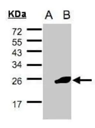 Anti-NCE2 antibody [C1C3] used in Western Blot (WB). GTX107726