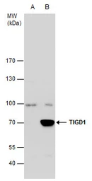 Anti-TIGD1 antibody [C3], C-term used in Western Blot (WB). GTX107727