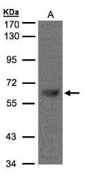 Anti-TBL1X antibody [C3], C-term used in Western Blot (WB). GTX107736