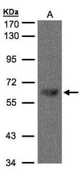 Anti-TBL1X antibody [C3], C-term used in Western Blot (WB). GTX107736