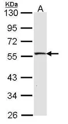 Anti-MST4 antibody [C3], C-term used in Western Blot (WB). GTX107741