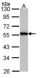 Anti-DOK3 antibody [C3], C-term used in Western Blot (WB). GTX107744