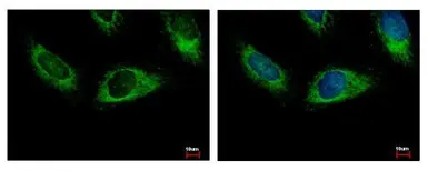 Anti-HPS3 antibody [C3], C-term used in Immunocytochemistry/ Immunofluorescence (ICC/IF). GTX107745
