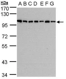 Anti-HPS3 antibody [C3], C-term used in Western Blot (WB). GTX107745
