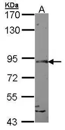Anti-SLITRK1 antibody [C3], C-term used in Western Blot (WB). GTX107746