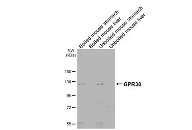 Anti-GPR30 antibody [C2C3], C-term used in Western Blot (WB). GTX107748