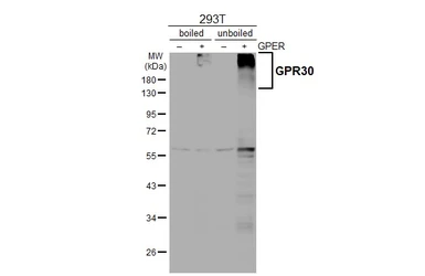 Anti-GPR30 antibody [C2C3], C-term used in Western Blot (WB). GTX107748