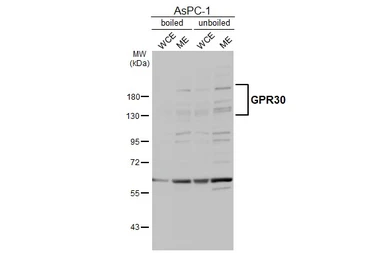 Anti-GPR30 antibody [C2C3], C-term used in Western Blot (WB). GTX107748