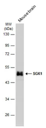 Anti-SGK1 antibody used in Western Blot (WB). GTX107750