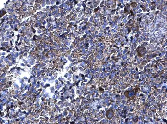 Anti-PFKFB4 antibody used in IHC (Paraffin sections) (IHC-P). GTX107755
