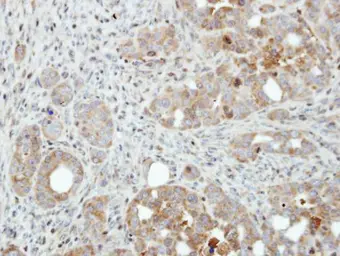 Anti-PFKFB4 antibody used in IHC (Paraffin sections) (IHC-P). GTX107755