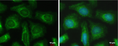 Anti-PFKFB4 antibody used in Immunocytochemistry/ Immunofluorescence (ICC/IF). GTX107755